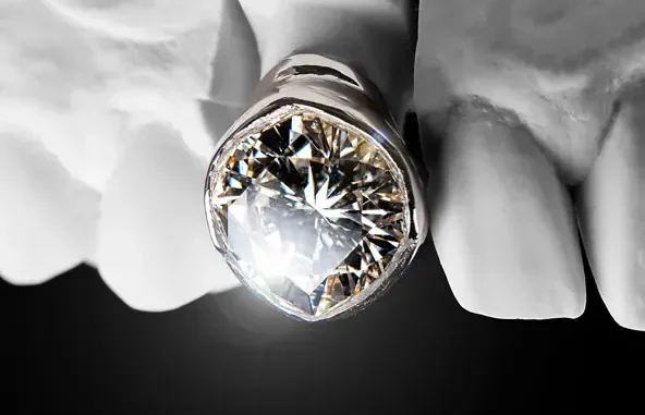Post Malone The Diamond Collection (Deluxe)